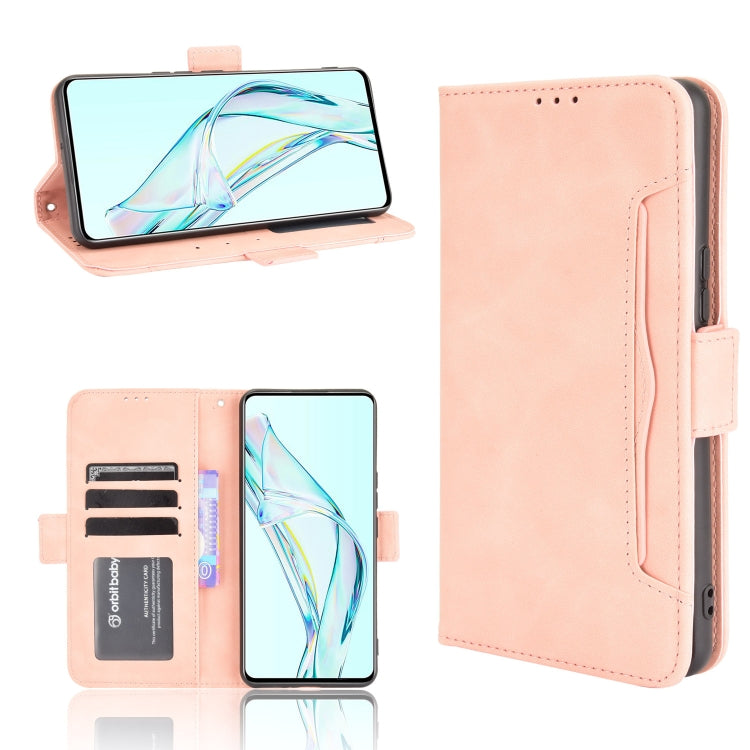 Skin Feel Calf Pattern Horizontal Flip Leather Case with Holder & Card Slots & Photo Frame, For Doogee S86 / S86 Pro, For Google Pixel 5a 5G, For Xiaomi Redmi 10, For Nokia C30, For Samsung Galaxy M21 2021, For Sony Xperia 10 III, For Xiaomi Mi Mix 4  ...